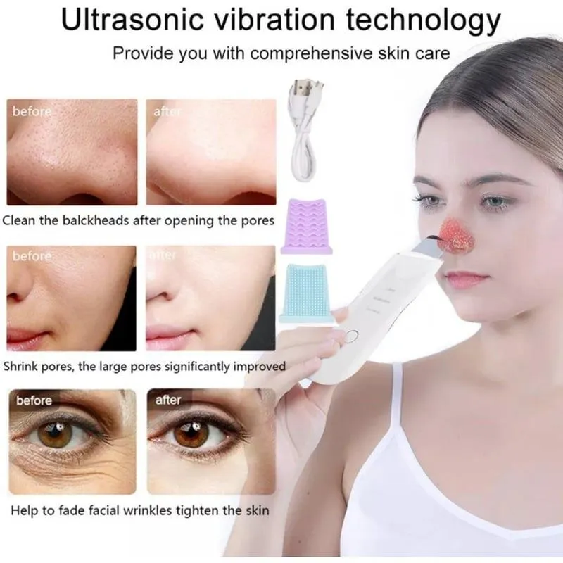 Limpiador facial espátula quita espinillas ULTRASONIDO