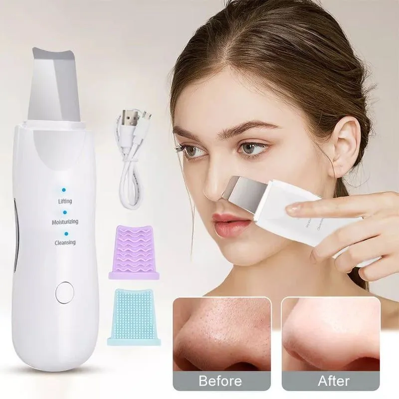 Limpiador facial espátula quita espinillas ULTRASONIDO