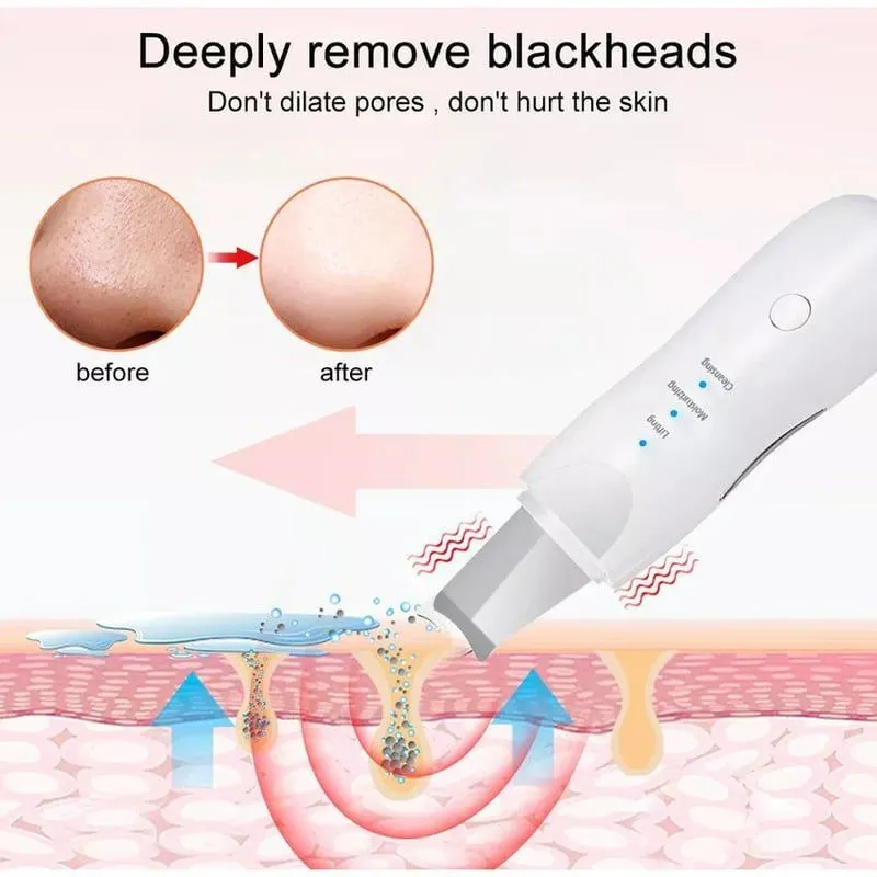 Limpiador facial espátula quita espinillas ULTRASONIDO