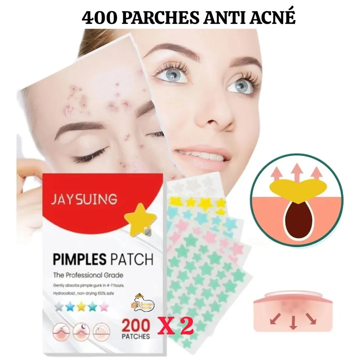 400 Parches ANTI ACNÉ - ESPINILLAS de Hidrocoloides en Estrella — Pañuelos faciales / pañuelos desechables